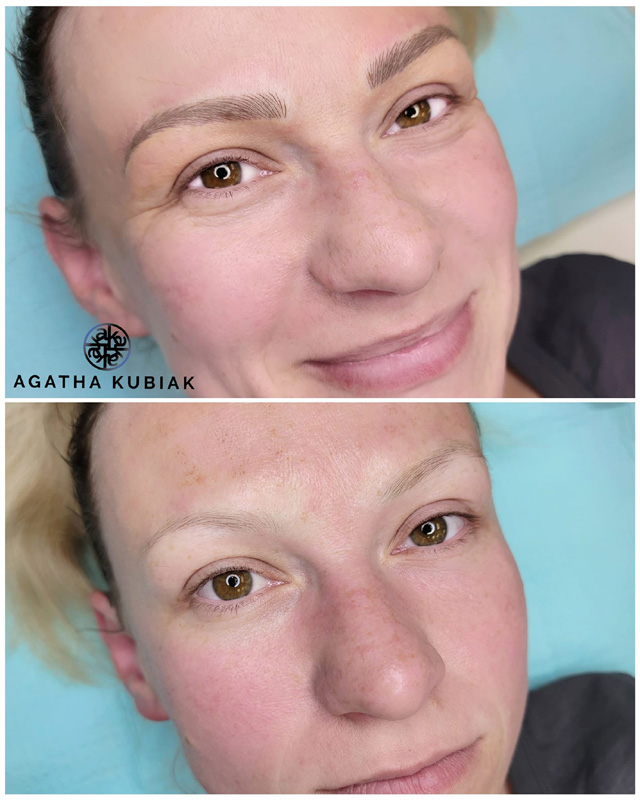 Before and After - Microblading Eyebrows.